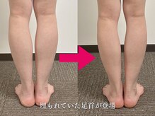 【つぼの奴隷】足つぼ整体専門店【6月28日 NEW OPEN（予定）】/むくみ撲滅★自信持って脚出せる