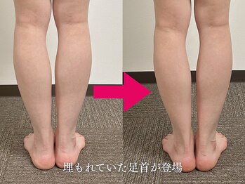 【つぼの奴隷】足つぼ整体専門店【6月28日 NEW OPEN（予定）】/むくみ撲滅★自信持って脚出せる