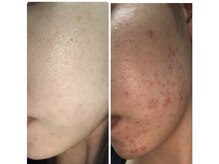 エトル(etole)/20代お客様症例写真