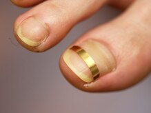 ブルーム(bloom)/スパンゲ