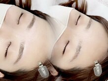 エムドット(m.)/アイブロウワックス脱毛