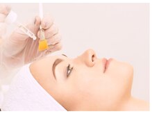 ソフィア ミューズ 目黒/皮膚科医監修の乳酸ピーリング