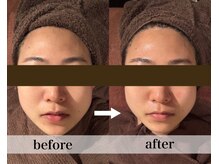 美容整体 ココ(COCO)/