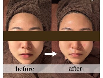 美容整体 ココ(COCO)/