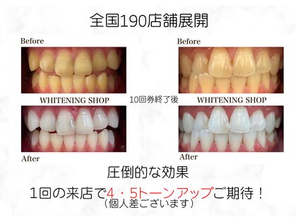 ホワイトニングショップ 池田店の写真