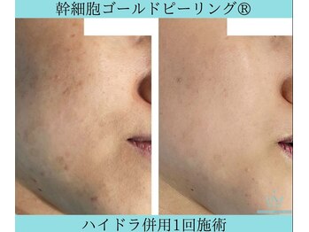 リメイク 広尾(REMAKE)/