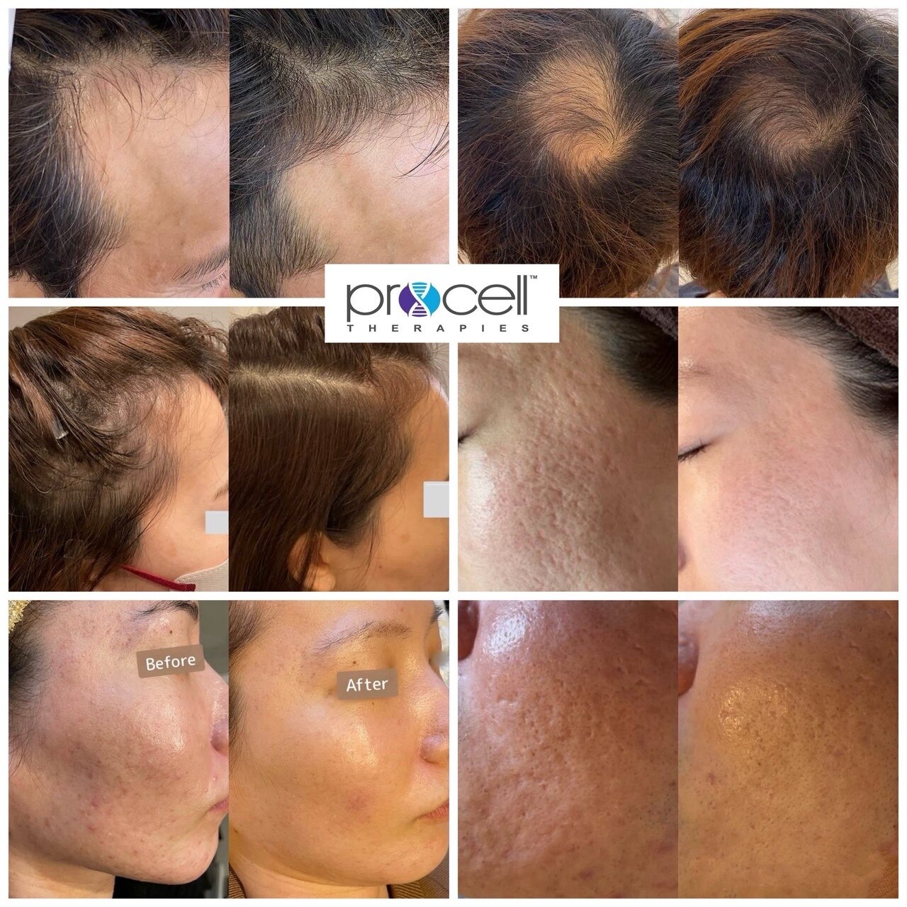 クレア(crea)｜ホットペッパービューティー