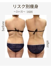 エステサロン 美飾り イオンモール木更津店/before⇒afteｒ/全身痩せ