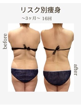 エステサロン 美飾り イオンモール木更津店/before⇒after/全身痩せ