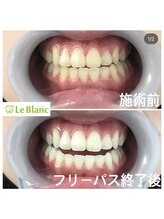 ルブラン 奈良店(Le Blanc)/なかなか落ちない黄ばみ汚れに