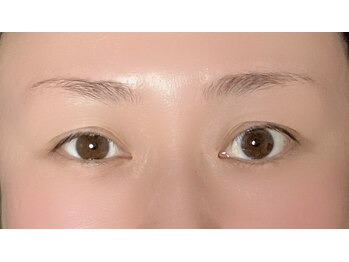 リリーマリア(Lily Maria)/殿堂人気☆小顔ケアbefore/after