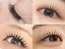 コア(Koa)