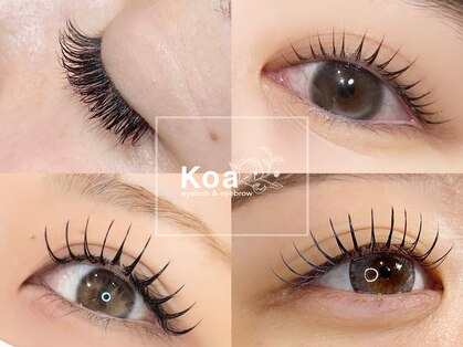 コア(Koa)の写真