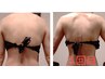 【肉厚・背肉・肩こり専用】筋膜ケアボディ40分￥11,000→7900