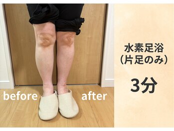 ヨサパーク フレア(YOSA PARK)/水素足浴（片足のみ） 3分