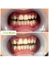 ルブラン 奈良店(Le Blanc)/夏休みが終わる前に！