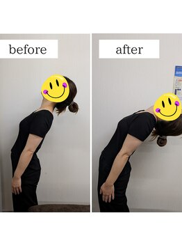 マナスタ(mana stu)/整体beforeafter