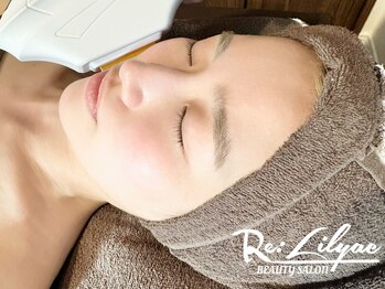 リリアック(Re:Lilyac)の写真/うぶ毛や毛穴の曇りを一気にクリア☆顔脱毛で清潔感あふれる明るい表情に◎触れたくなるようなつるすべ肌へ