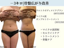 京都フォーエイチ(京都4H)/－3キロ|骨盤広がり改善