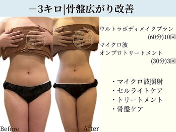 京都フォーエイチ(京都4H)/－3キロ|骨盤広がり改善