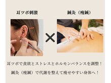 ルリアン(LE LIEN)の雰囲気(耳ツボと鍼灸(痩鍼)で痩せやすい身体づくりをサポートします)