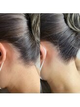 アイラッシュサロン ドール(Doll)/【レディース】うなじ脱毛