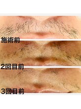 シロ(SHIRO)/お髭がなくなってます