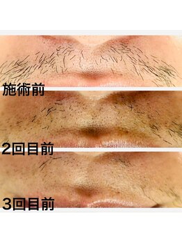 シロ(SHIRO)/お髭がなくなってます