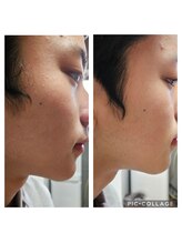 ミホズルーム(Miho‘s room)/透明感UP