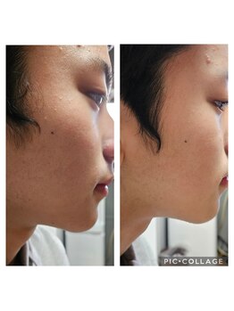 ミホズルーム(Miho‘s room)/透明感UP