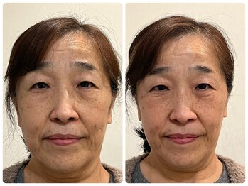 たかさきひかり鍼灸整骨院/お客さんのBeforeAfter