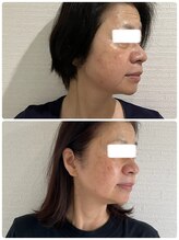 ビープラスサロン(Be plus salon)/