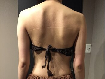 リシェラード/【プレ花嫁様】上半身引締め2回