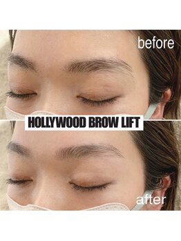 ラドアー(Radoor)/ハリウッドブロウリフト