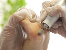 ブルーム(bloom)/