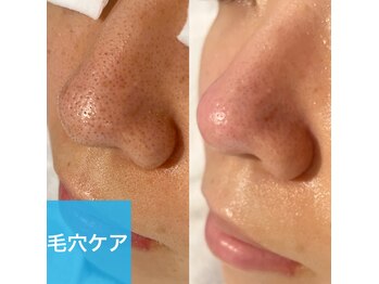 ミニョンプラス(Mignon+)