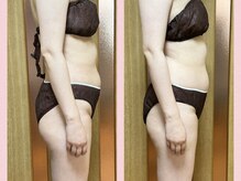 ヨサパーク ひだまり 日立店(YOSAPARK)/ヒップアップ＆小尻