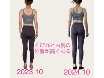 フォーシー(4C)/Before/After