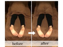 美容整体 ココ(COCO)/