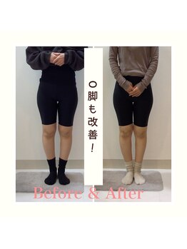 スタイルラボ高松/産後骨盤矯正の効果♪