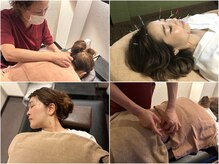 ぶっちょ整骨院 くずは鍼灸院の雰囲気（院長経験女性鍼灸師の確かな施術◎痛み・小顔・リフトUP人気★）