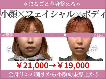 スイッチ(Switch)/小顔とボディで全身スッキリ♪
