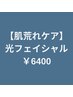 【肌荒れケア】 光フェイシャルエステ　￥6400（税込）