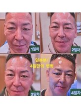 ICDスキンスタジオ 新宿三丁目(ICD-skin studio)/Before-After