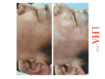 シューラディアント(ShuRadiant)/韓国ララピール