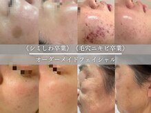 スパ ザ トルトル(SPA The toltol)