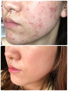 スリリアン 銀座/★お客さまビフォーアフター★