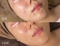 エイプリルフールズ(April fools)