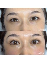 クレール(clair)/目元が変わるアイパワーエステ