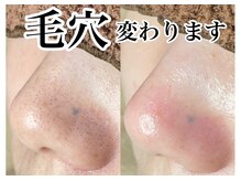アンドピエル(AndPiel)/毛穴の黒ずみ撃退！